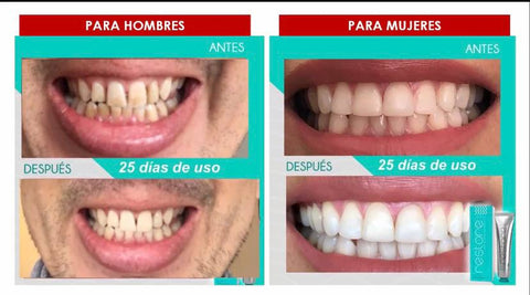 Image of RESTORE GEL DENTAL - Blanqueador con Nanotecnología