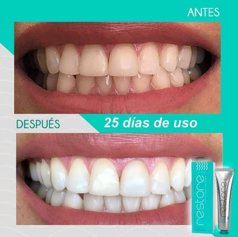 Image of RESTORE GEL DENTAL - Blanqueador con Nanotecnología