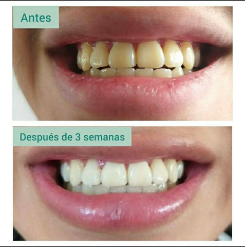 Image of RESTORE GEL DENTAL - Blanqueador con Nanotecnología